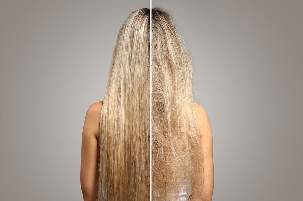 Hair Loss For Women
