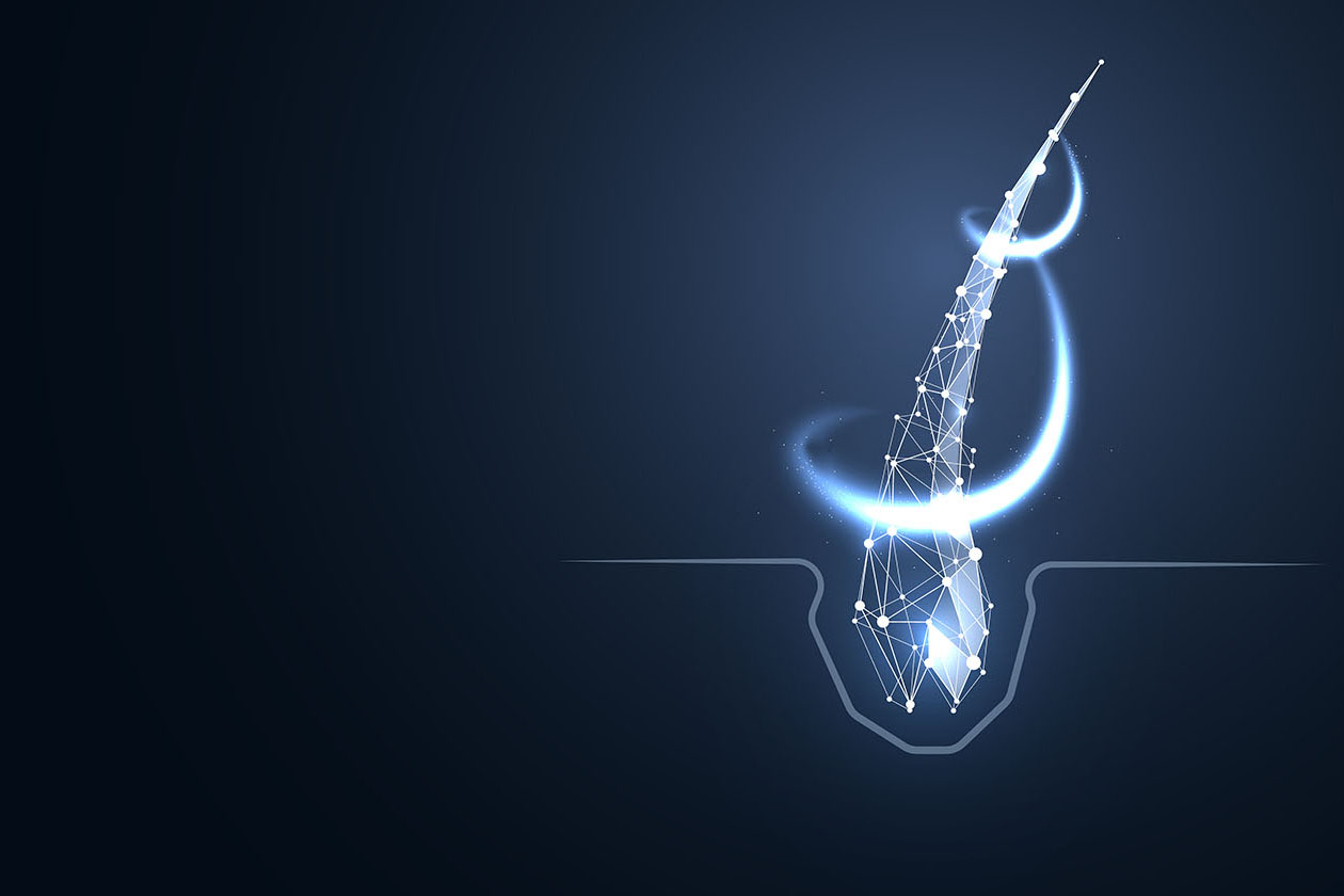 Mesotheraphy Hair Injections