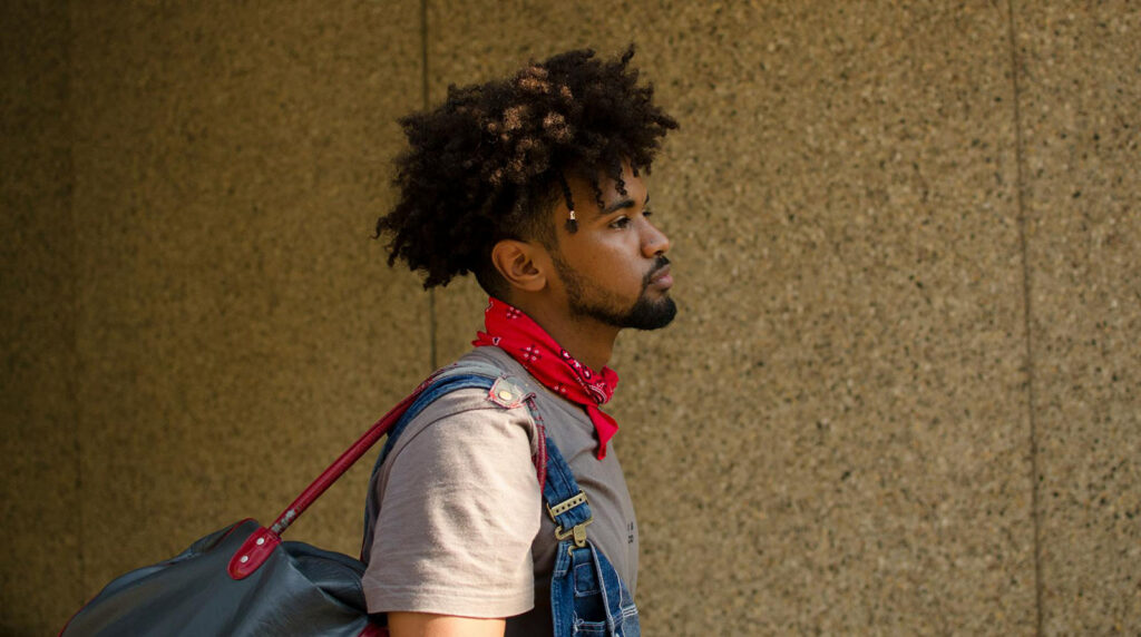 Afro Hair Transplant